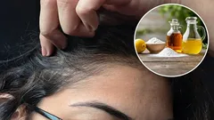 Was sind die Vorteile der Verwendung von Essig und Backpulver gegen graues Haar und wie wendet man sie richtig an?